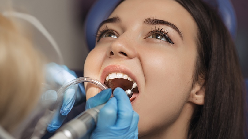 Regular cleaning by a dental hygienist is an important way to keep your teeth looking great.