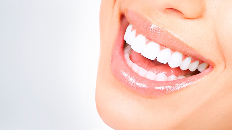 Dental veneers can correct a wide range of cosmetic issues, including worn, chipped and discolored teeth.