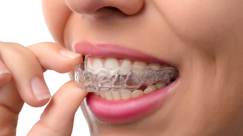 TMJ therapies will be personalized to your mouth and the underlying problems.