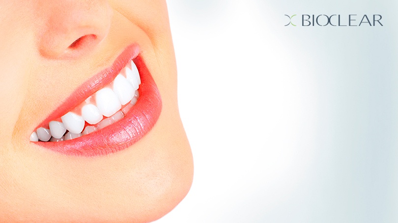 The Bioclear Method is an innovative procedure that can correct dark spaces and damaged teeth.
