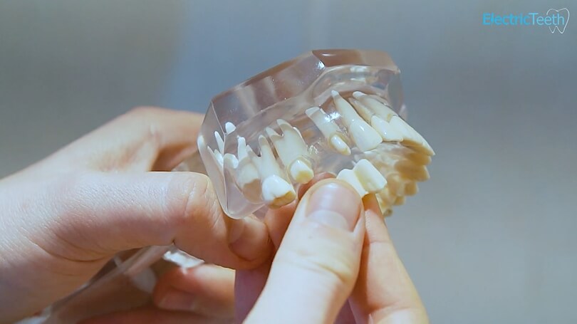 A dental bridge at our Scottsdale office is custom-made to match remaining teeth.