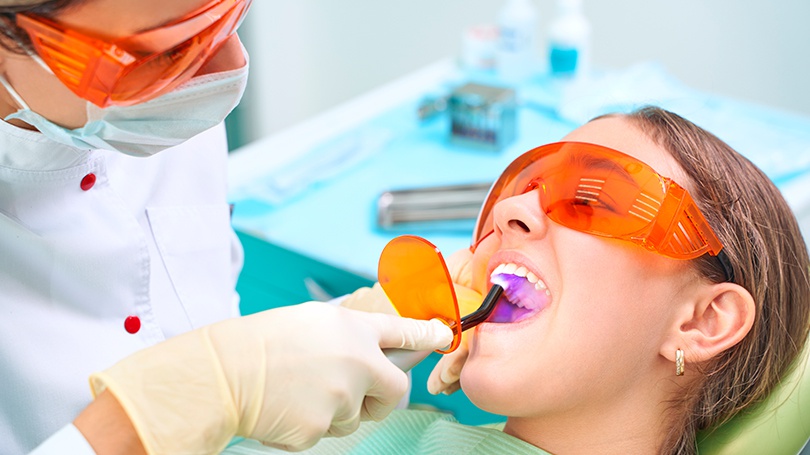 Tooth-colored fillings are a popular option because the result is practically imperceptible.