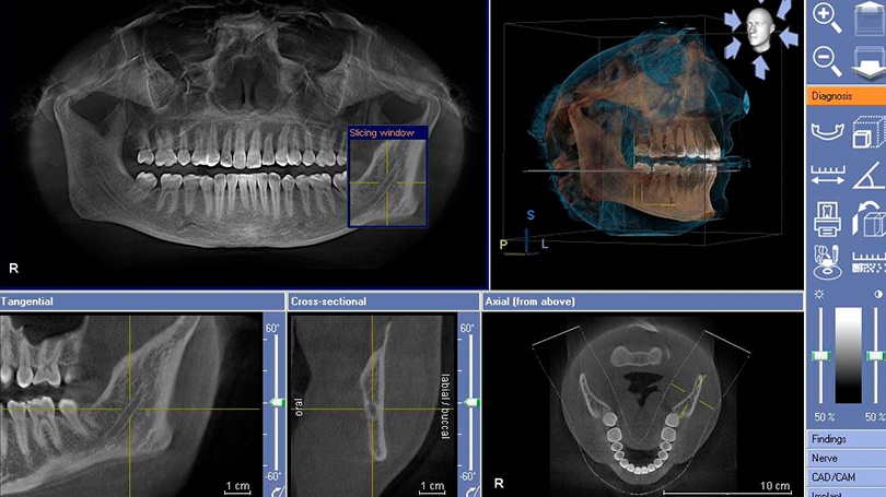 The Galileos imaging provides a 3D perspective of your entire mouth and other areas.