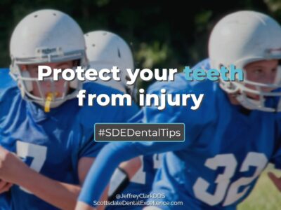 Young athletes should wear mouthguards custom-made by their dentists.