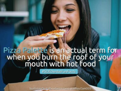 Burning the roof of your mouth with a slice of pizza is known as pizza palette.