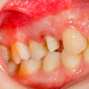Oral health issues can lead to and exacerbate systemic health issues.