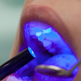 Dentists are crucial to the early diagnoses of oral cancer.