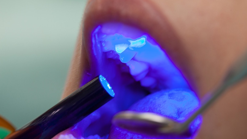 When it comes to cancers of the mouth and throat, dentists are integral to early diagnoses.