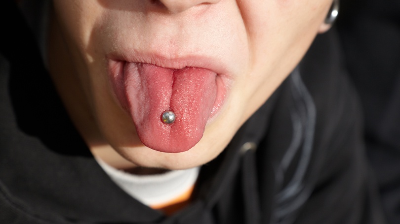 Oral piercings can be a way to express yourself, but they also introduce additional risks to your mouth.