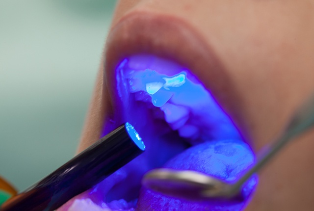 Oral cancer screening is part of every regular checkup here at Scottsdale Cosmetic Dentistry Excellence.