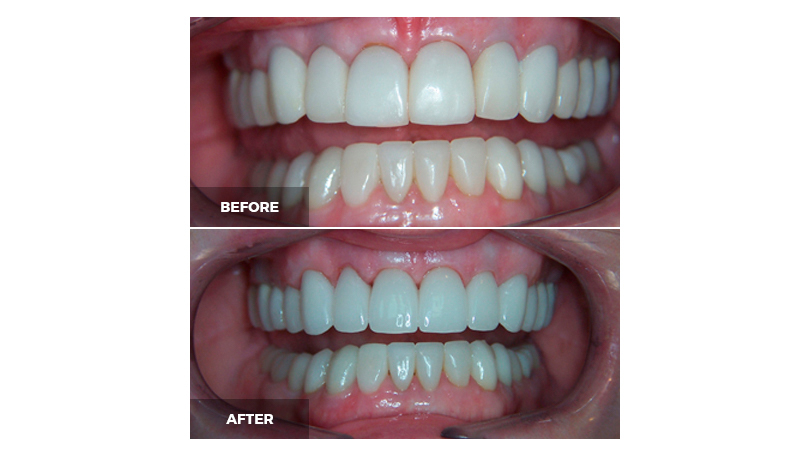 Issues with your gums can diminish attractiveness, and those can be fixed as well.