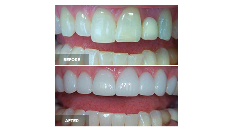 Even genetic imperfections, such as differently shaped teeth, can be overcome.