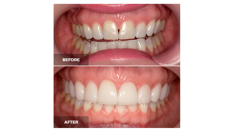 It is amazing what a modern smile makeover can achieve.