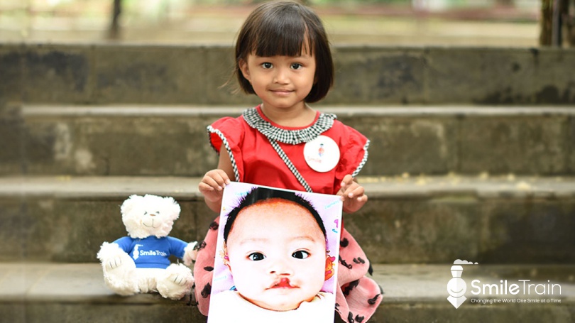 Thanks to Smile Train, children with cleft palates can enjoy a healthy, productive life.
